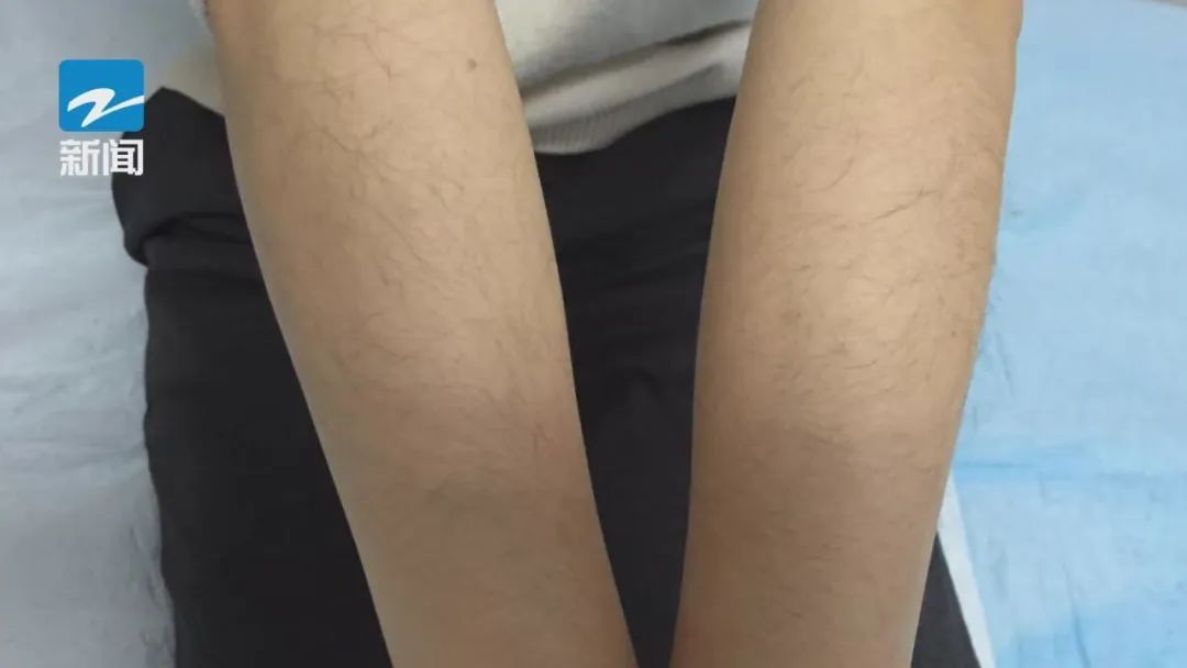 大翻车!30岁女子变身原始人,只因这款神器使用不当