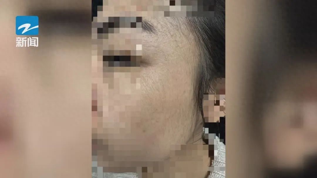 大翻车！30岁女子变身原始人，只因这款神器使用不当